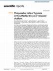 Research paper thumbnail of The possible role of hypoxia in the affected tissue of relapsed clubfoot