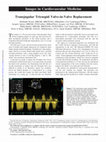 Transjugular Tricuspid Valve-in-Valve Replacement Cover Page