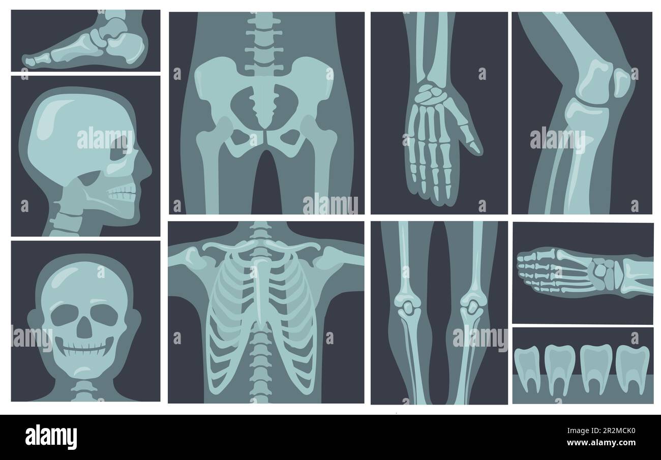 X-ray shots of human body Stock Vector