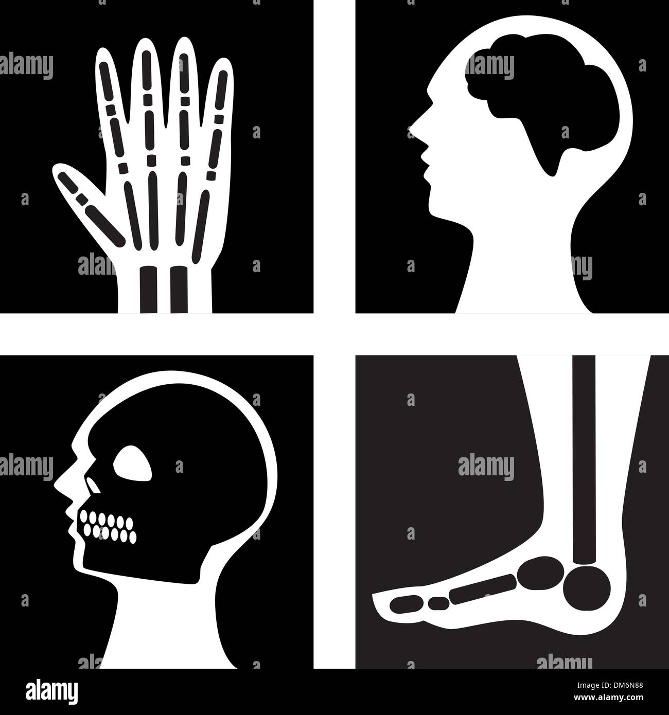 Xray Stock Vector