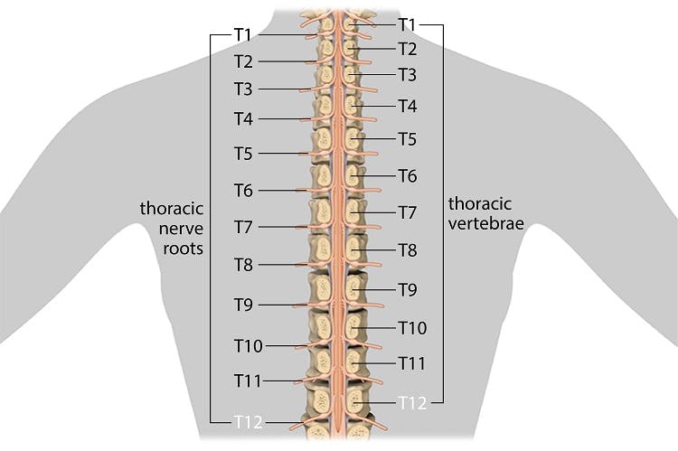 T12 Bone Fracture