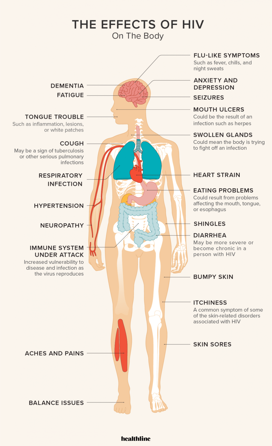 Detail Gambar Hiv Aids Nomer 36