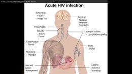 Detail Gambar Hiv Aids Nomer 44