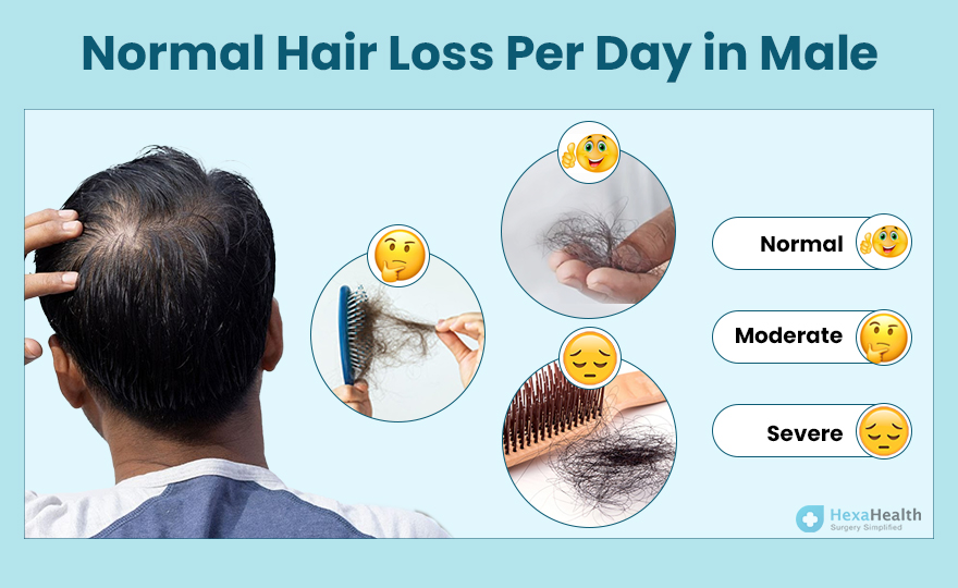 How much Male Hair Loss is Normal Per Day?