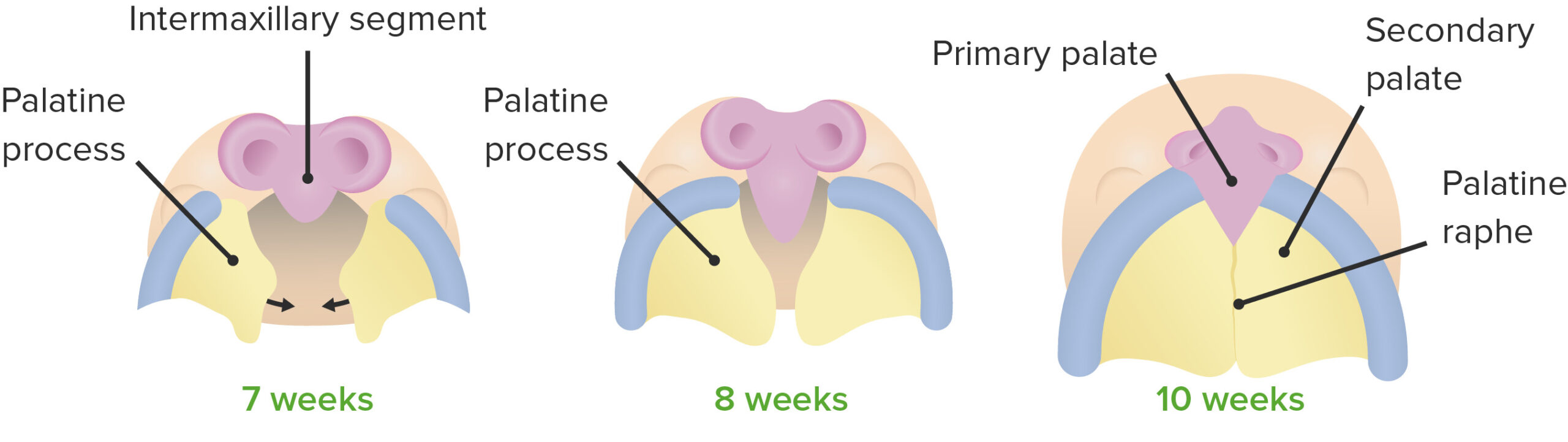 Cleft Palate Anatomy