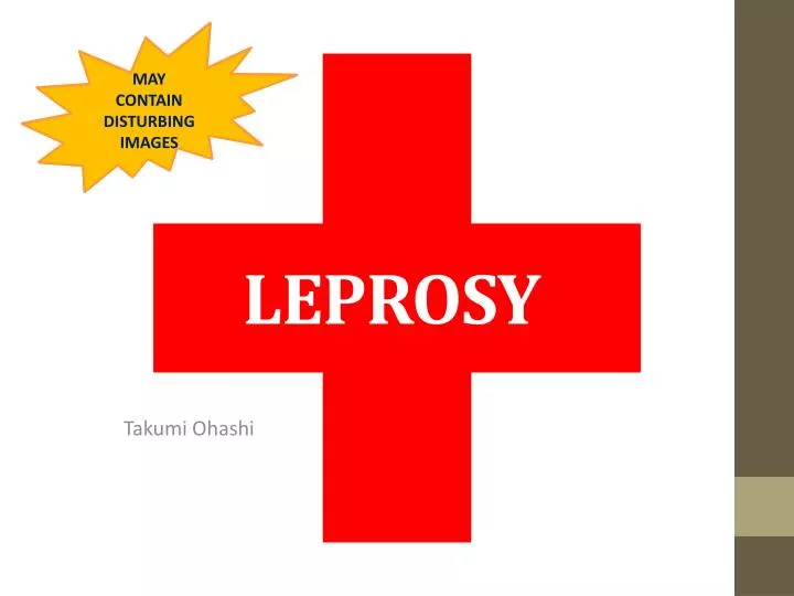 leprosy