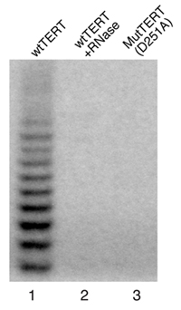 In vitro Reconstitution of the Active T. castaneum Telomerase (Video ...