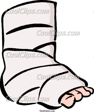 Leg in a cast clipart.