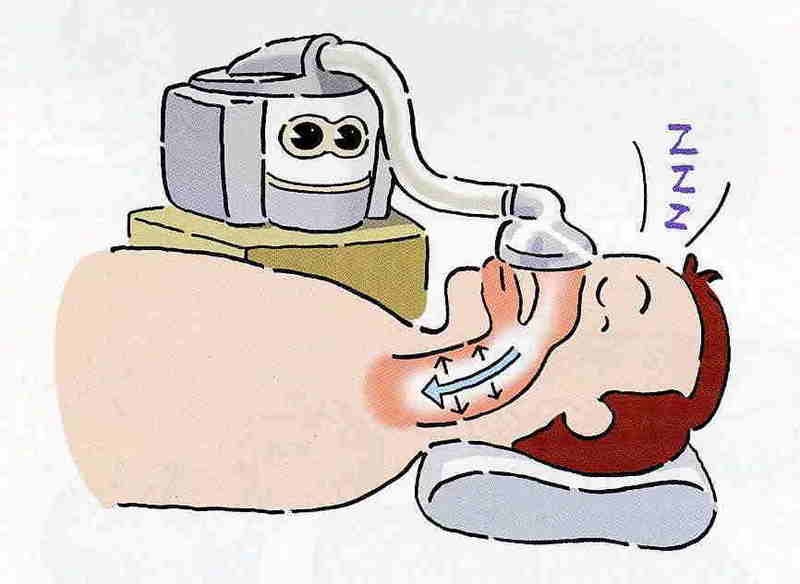 cpap.