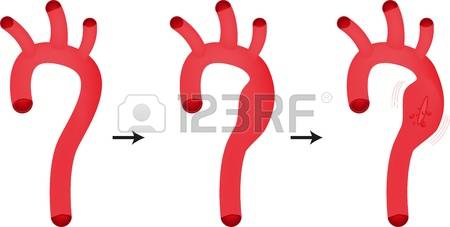 Aorta clipart.