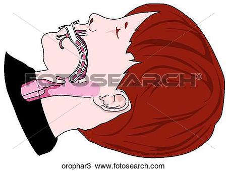 Airway Stock Illustrations. 836 airway clip art images and royalty.