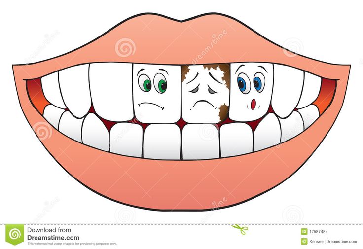 Bad Tooth Clipart.