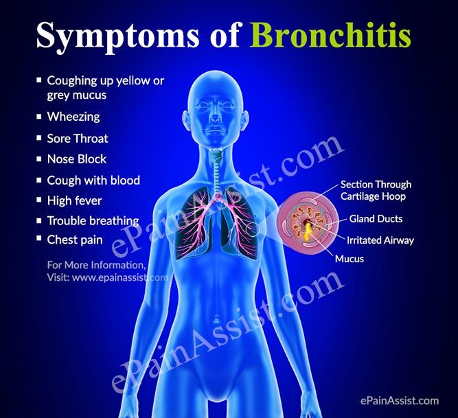 Bronchitis: How do You Get Bronchial Infection & What is its.