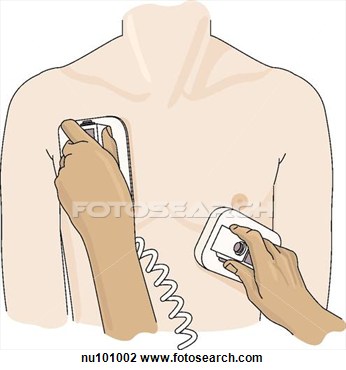 Defibrillator Paddles Clip Art.