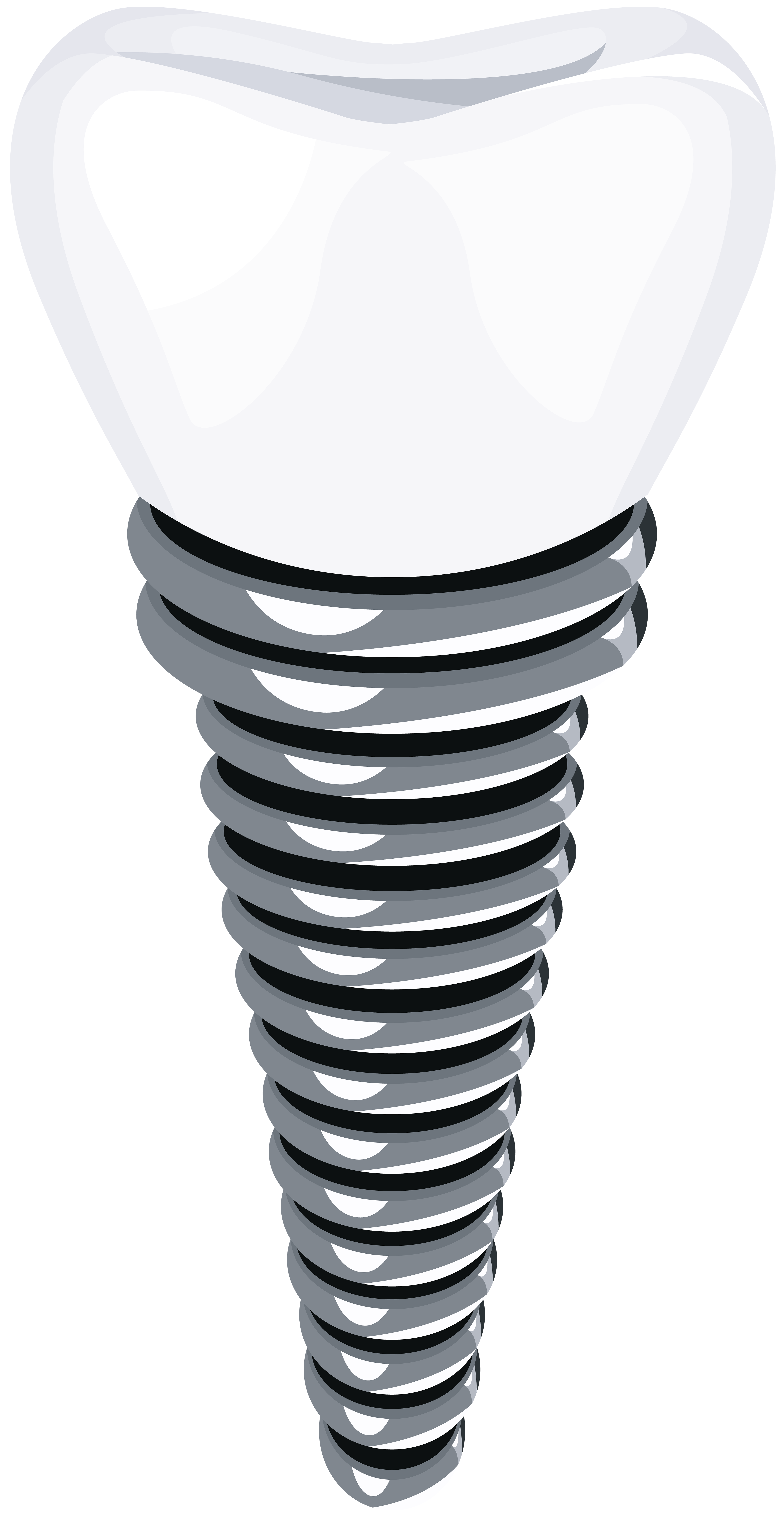 Dental Implant PNG Clip Art.