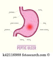 Dyspepsia Clip Art EPS Images. 41 dyspepsia clipart vector.