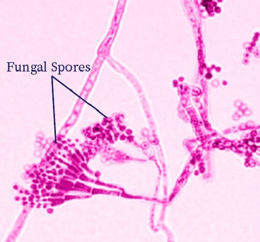 A microscopic image of Penicillium roquefortii; the fungus used in the production of blue cheese.