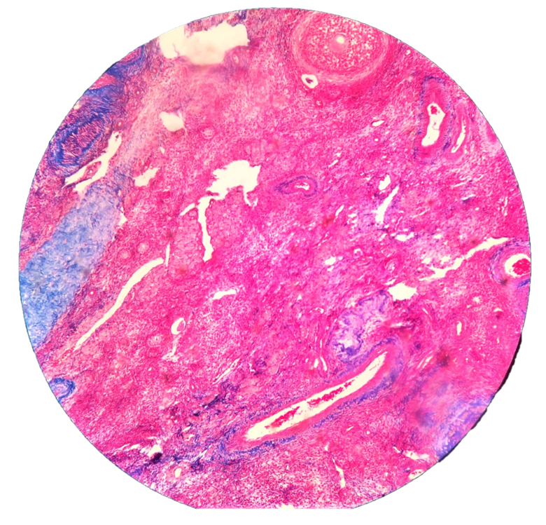 "Histology of mammalian ovary"