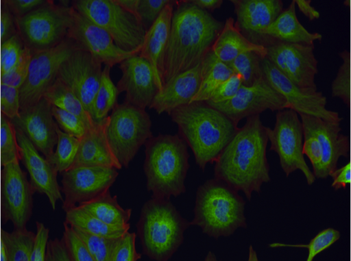 Aurora kinase inhibitor