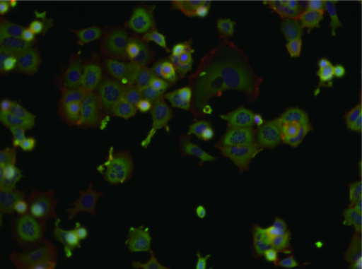 Tubulin destabilizer