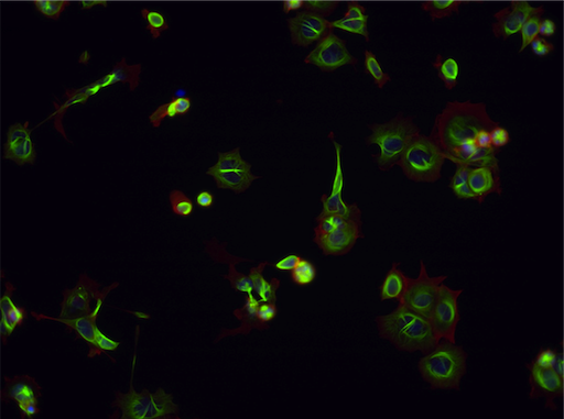 Tubulin stabilizer