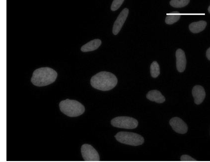 Hoechst 33342 staining