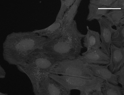 WGA + phalloidin staining