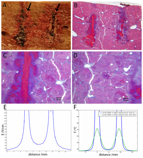  Study with 2 EDW separated by 30 s with time constants of 79 and 92 ms, the first and second pulse respectively, 1,000 V difference between electrodes placed at a distance of 15 mm between them, 10 mm exposed length, 100 µF capacitor. Liver was extracted 18.5 h after treatment.