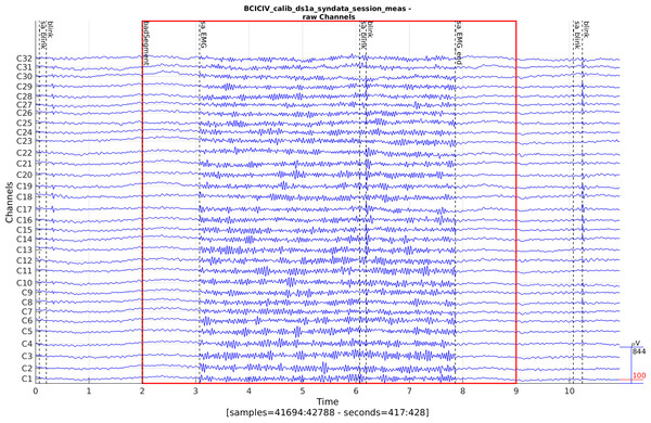 A bad data segment detected by histogram-based amplitude thresholding (CTAP_detect_bad_segments.m).