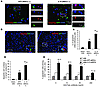 Enhanced proapoptotic effect of IL-10–aNSCs on inflammatory cells.