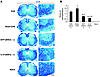 Transplanted aNSCs promote remyelination of demyelinated axons in spinal co