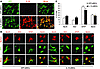 In vitro differentiation potential of transduced aNSCs.