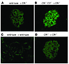 Glomerular C3 staining in renal transplant studies in Cfh–/– mice.