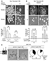 IL-6 sustains MS self renewal and MCF-7 spheroid formation.