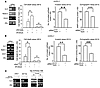 Autocrine IL-6 loop sustains a CA-IX–dependent malignant phenotype in HYPO-