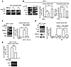 Autocrine IL-6 loop sustains a Notch-3/CA-IX–dependent aggressive phenotype