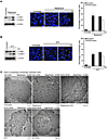 Effect of CQ on rapamycin- and DTT-triggered autophagic process.