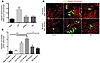 CLP promotes the development of micrometastases, which is attenuated by tre