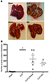 Systemic sepsis promotes the development of gross metastasis, which is atte