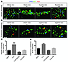 Tumor cell adhesion after CLP is augmented by trapping within neutrophil-de