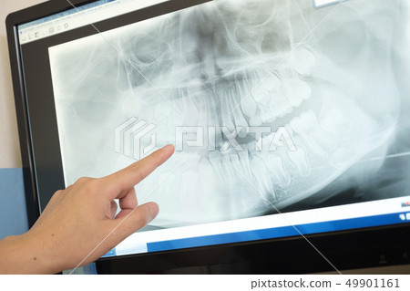 Radiograph of teeth 49901161