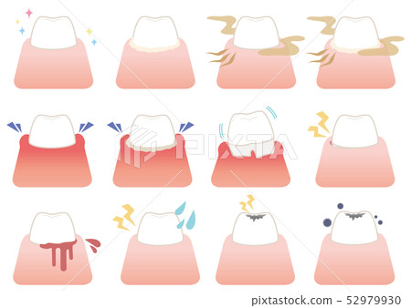 Tooth symptom set illustration 52979930