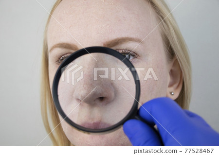 A woman examines dry skin on her face. Peeling, coarsening, discomfort, skin sensitivity. Patient at the appointment of a dermatologist or cosmetologist, selection of cream for dryness 77528467