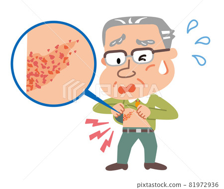 Illustration of an elderly man confirming a rash 81972936