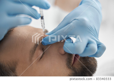 Beautician does injection of lifting filler in nasal bridge of mature man in clinic closeup 83340333