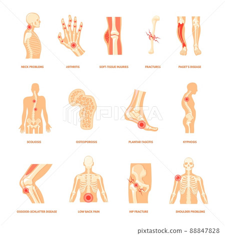 Body orthopedic problem. Human bone injury, anatomy health diseases plantar fasciitis arthritis joint fracture foot pain shoulder knee back ankle sport injuries cartoon neat vector 88847828