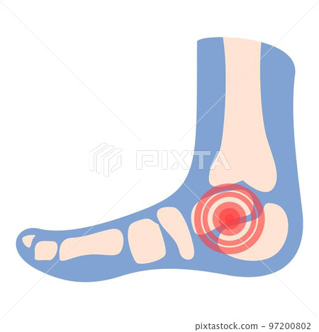 Foot articulation icon cartoon vector. Medical patient. Arthritis joint 97200802