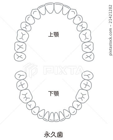 Tooth alignment 21421282