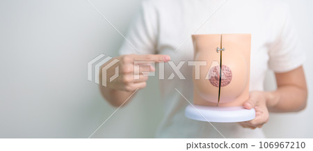 woman holding Breast Anatomy model. Breast Augmentation Surgery, October Breast Cancer Awareness month, implant, Diagnosis, Beauty woman enlargement and medical education concept 106967210