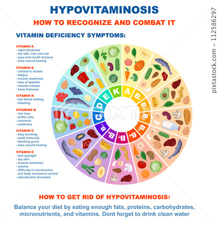 Vitamins infographic and vitamin deficiency symptoms. Food sources of different organic molecule for proper metabolism. Healthy eating and diet. Flat vector illustration 112586297